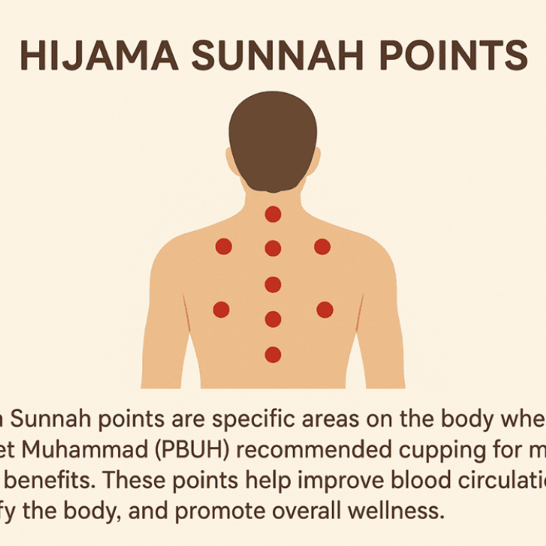 hijama sunnah pints